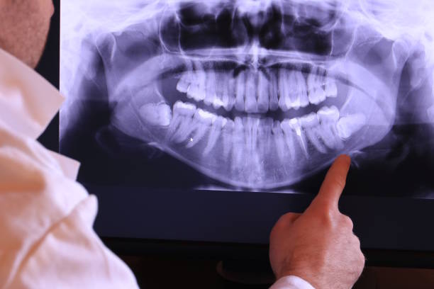 Best Emergency Root Canal Treatment in Robins, IA