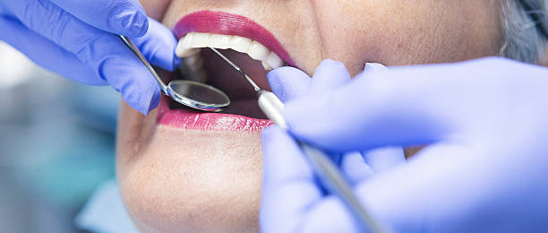 Best Emergency Treatment for Toothache in Robins, IA
